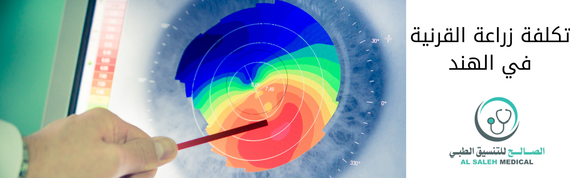  تكلفة زراعة القرنية في الهند| المخاطر وأفضل العلاج 